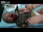 syria aleppo ,Children Injured By  Shelling
