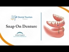Snap On Denture Cancun - Dental Tourism Mexico
